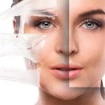 Consider Before And After Chemical Peel | Glow Bright Med Spa