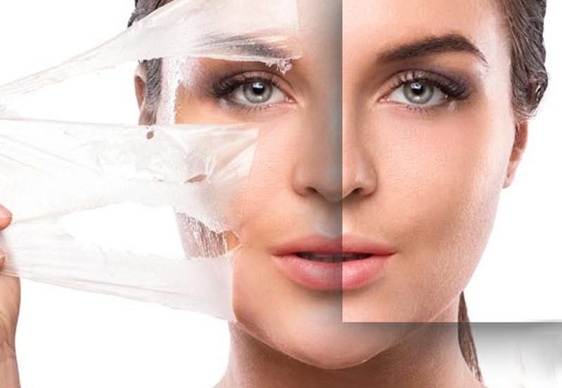 Consider Before And After Chemical Peel | Glow Bright Med Spa