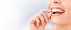 dental invisalign treatment