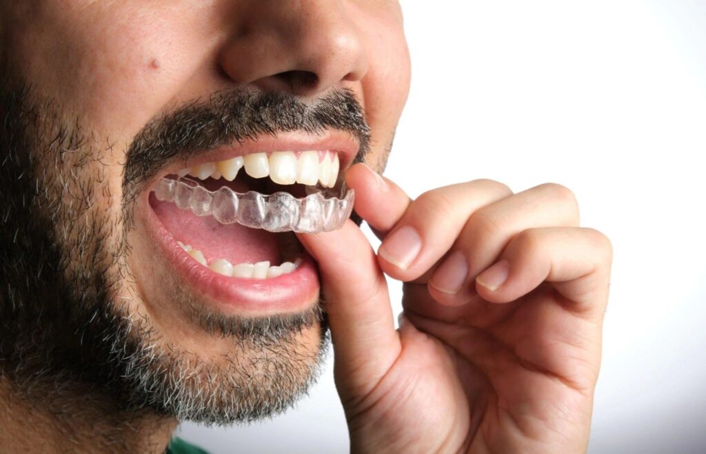 Invisalign treatment in Agoura Hills